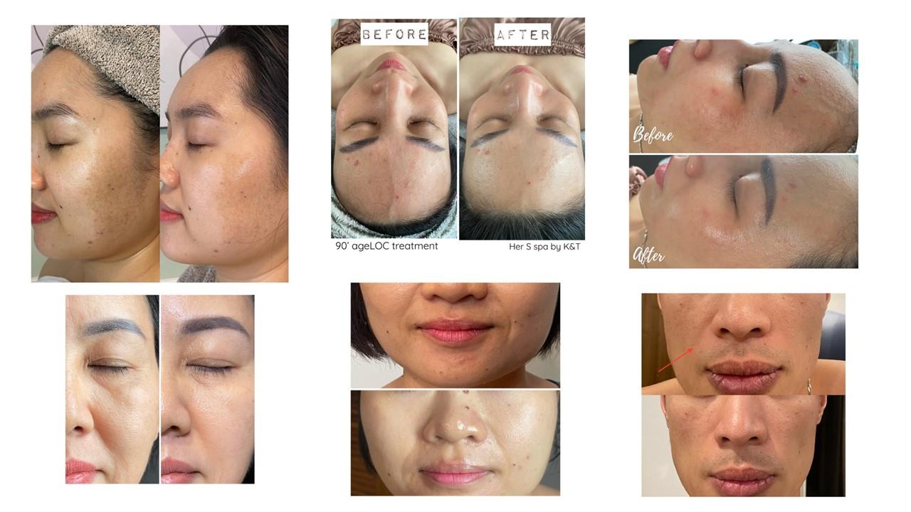 Kết quả ngay lập tức từ lần đầu tiên